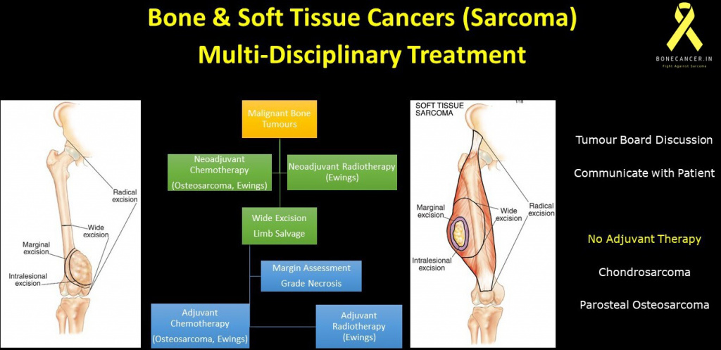 Bone & Soft tissue sarcoma Tumour Board