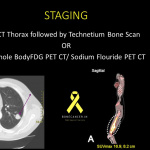 PET CT in Sarcomas
