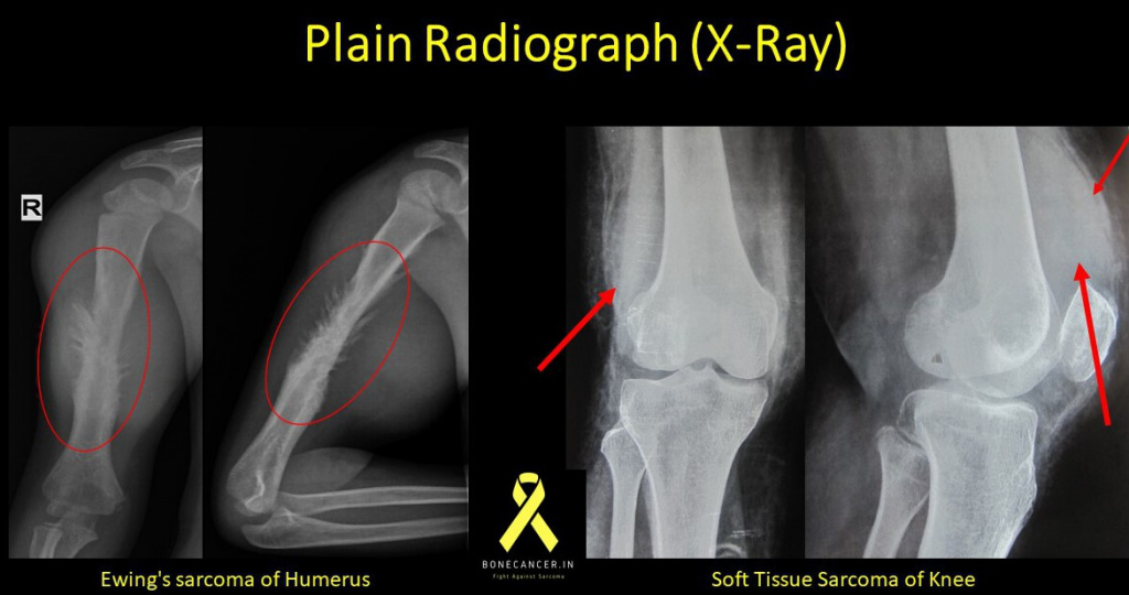 X ray 