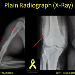 X ray